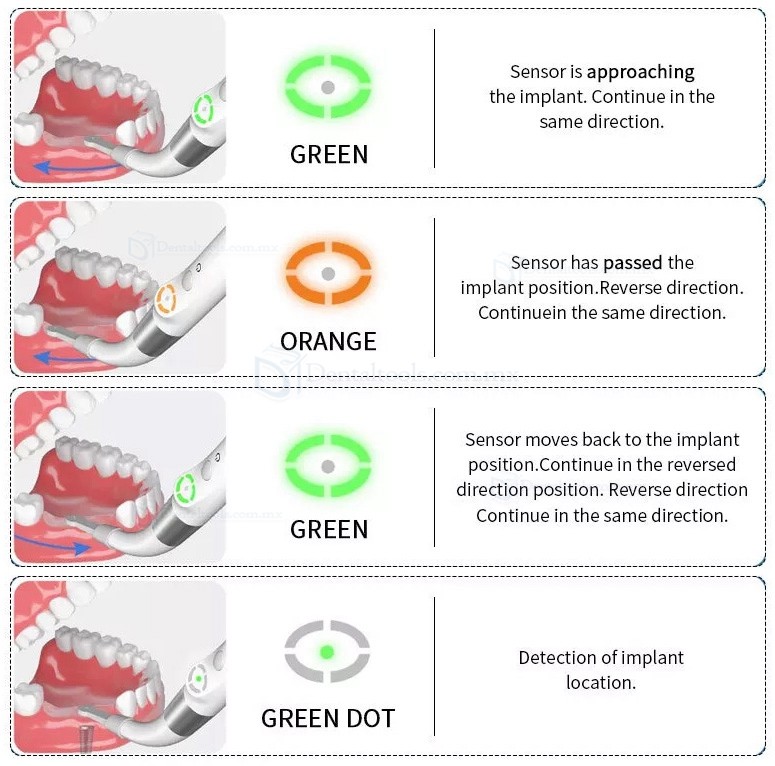 YAHOPE iD1 Detector de implantes localizador de implantes dentales sensor inteligente giratorio de 360°