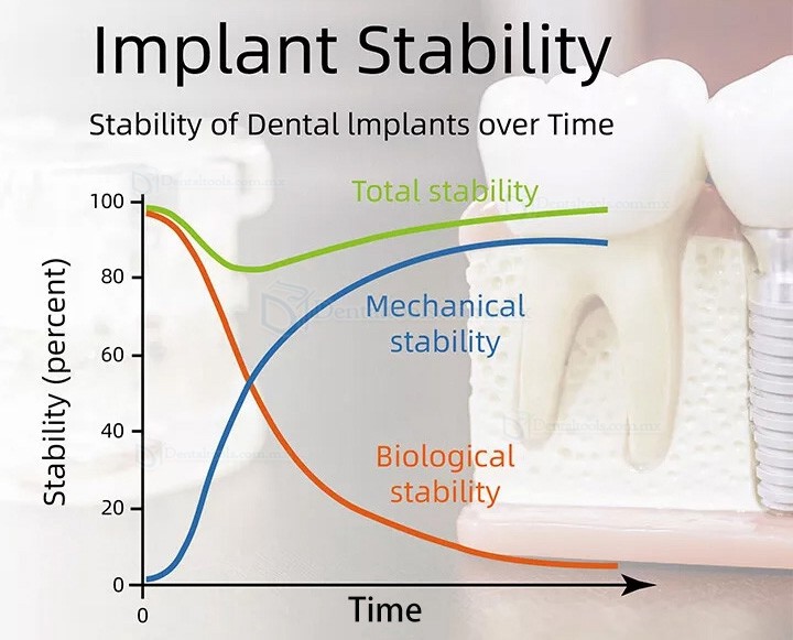 YAHOPE iCHECK Medidor de estabilidad de implantes portátil dispositivo de monitorización implantes dentales